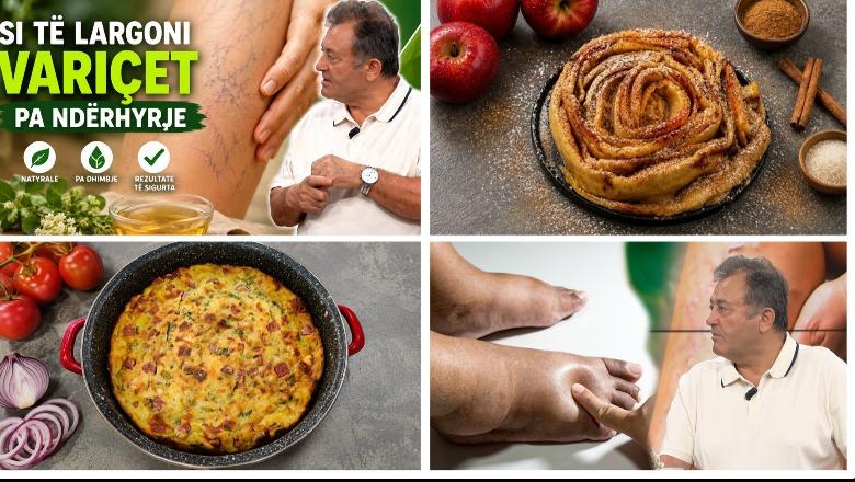 Emisioni i plotë ‘Rreze Dielli’, 15 Qershor 2026 – Receta / Variçet, shkaktarët dhe trajtimi natyral
