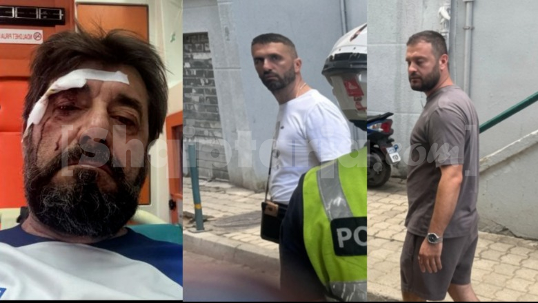 Sherr për gjobat e makinave, dhunohet analisti Ilir Demalia! Report Tv siguron fotot e 2 autorëve