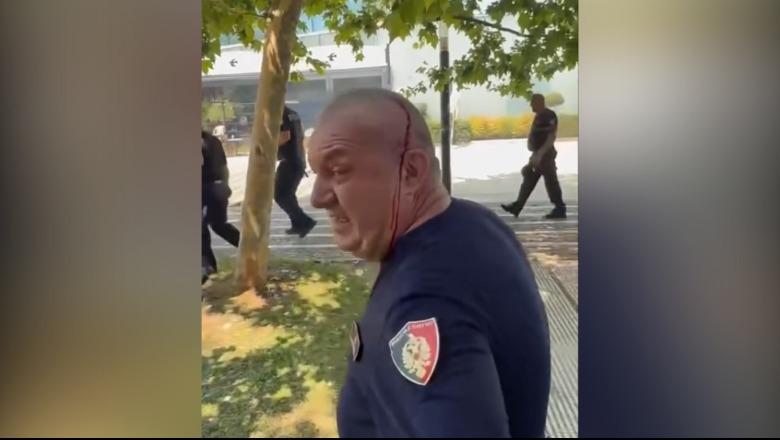 'Protesta ia la vendin sherrit dhe dhunës', Balla publikon foton e efektivit të plagosur: Prej 32 vitesh në detyrë, sot e gjakosën