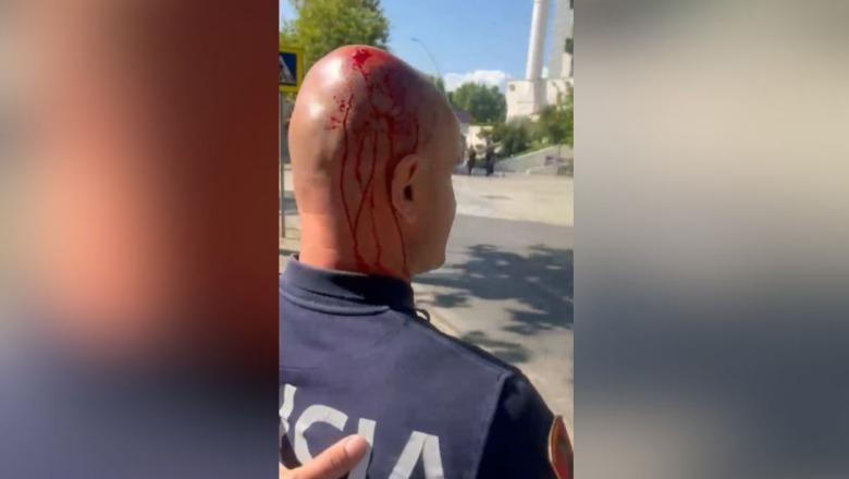 Polici i mbuluar në gjak nga sulmet e protestuesve, Balla: S’është më protestë paqësore, por terrorizëm