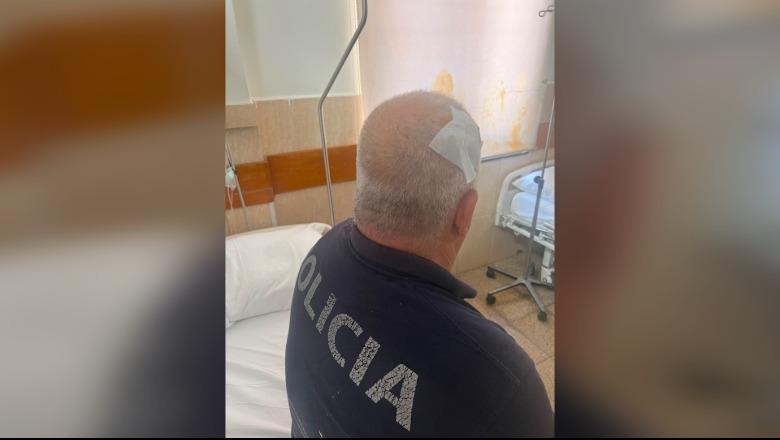 Me plagë në kokë, pamjet e efektivëe të lënduar në  përplasjet para Kuvendit