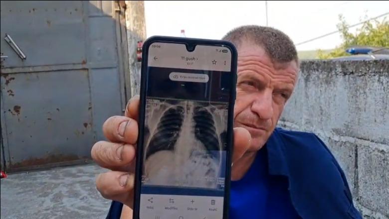 Me brinjë të dëmtuara e ilaçe në xhep, zjarrfikësi në Krujë s’e braktis detyrën: Do ta bëjmë me zemër