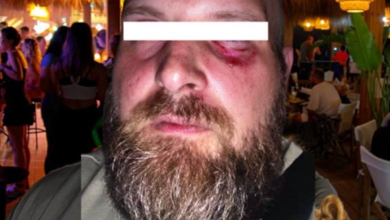 'E rrahën 7 kamarier, policia nuk erdhi', dhunohet në club-in e njohur në Golem turisti shqiptaro-gjerman