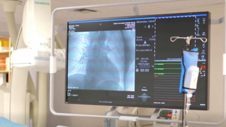 Investimi te 'Shefqet Ndroqi', dyfishohen sallat për ndërhyrjet e zemrës!! investimi i ri rrit kapacitetin nga 10 në 16 pacientë në ditë 