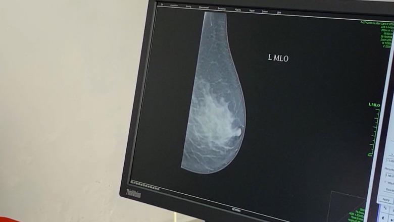 Fier, mesatarisht çdo ditë një person diagnostohet me kancer! Shifrat rriten frikshëm, 400 raste në 9 muaj, dominon kanceri i mushkërive