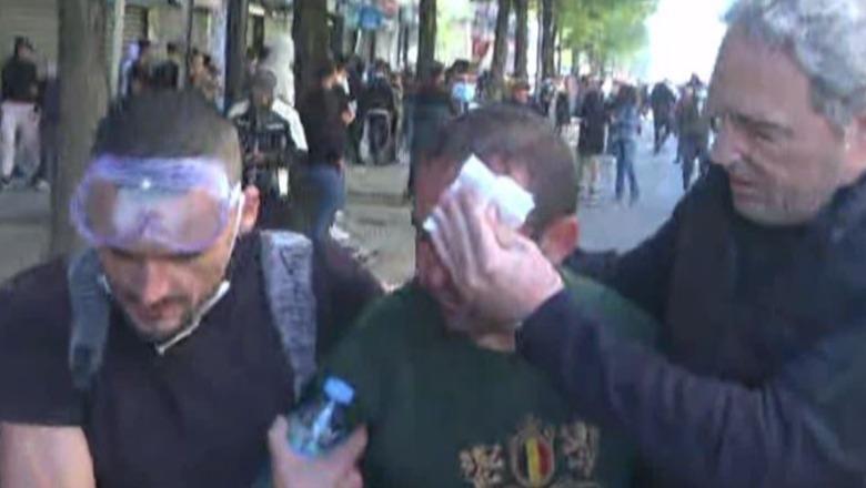 Protesta e dhunshme në Tiranë, protestuesi merr dëmtime te pjesa ballit! Spahia e ndihmon