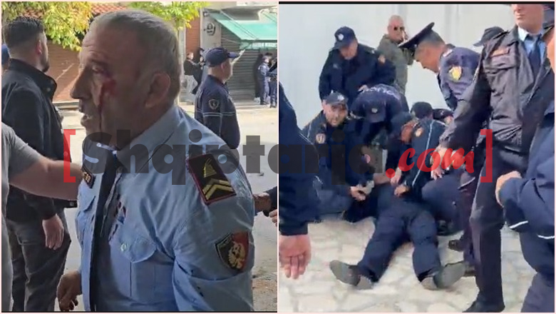 Sulme me gurë e sende të forta ndaj policisë në Shkodër e Durrës, plagosen 2 efektivë! Njëri goditet në kokë dhe dërgohet me urgjencë në spital