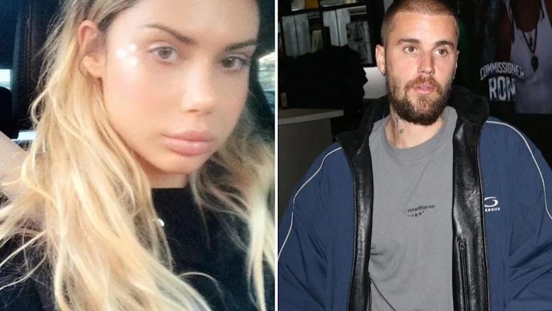 Ish e dashura e Justin Bieber? Modelja e njohur australiane ndahet nga jeta në moshën 34-vjeçare